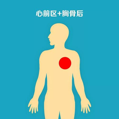 急性心梗10个常见的疼痛部位熟记能救命