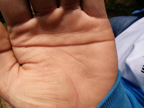 左手手掌中线是一条,待解