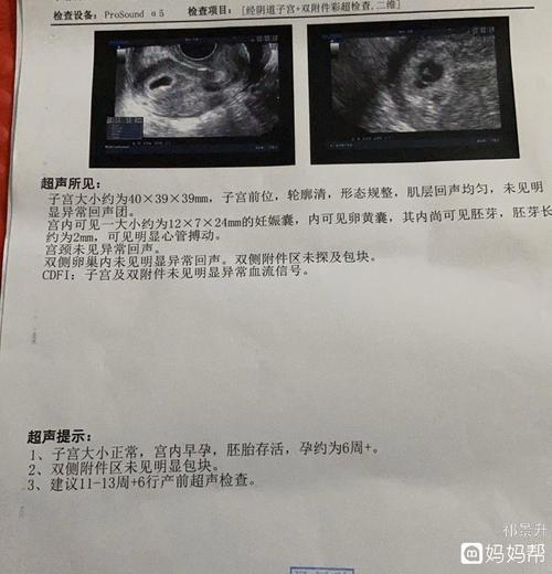 这是宫角妊娠吗,会回正吗,回正几率大不?