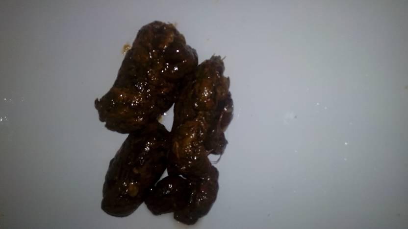 大便成这种颜色是什么意思.胃有时候还会痛还有右下腹也有点隐痛