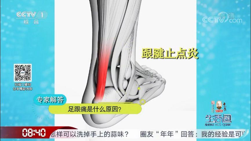 足跟痛该咋办?记住这几招,轻松缓解!