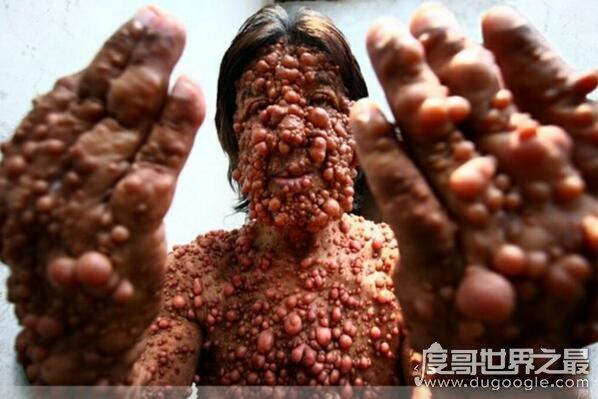 超恶心的密集恐惧症图片大全,密集测试图欢迎挑战(慎入)(2)