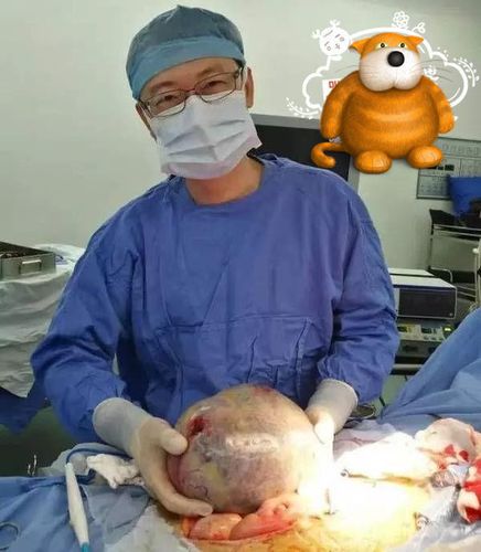 妈妈的1个疏忽,宝宝的睾丸长成特大肿瘤,做手术时医生