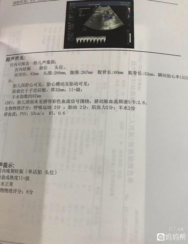 孕33周宝宝是不是腿短,体重好轻啊,可我