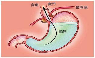 扁桃体|炎症|咽部_鸵鬃订阅