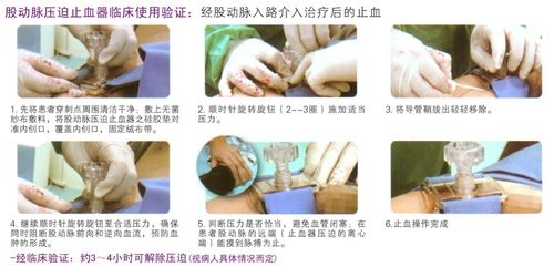 首页 产品中心 一次性动脉压迫止血器    股动脉止血器   所属分类