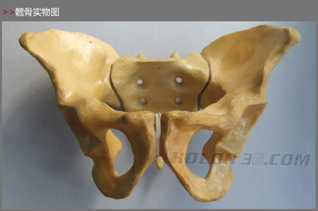 髋骨三维扫描案例