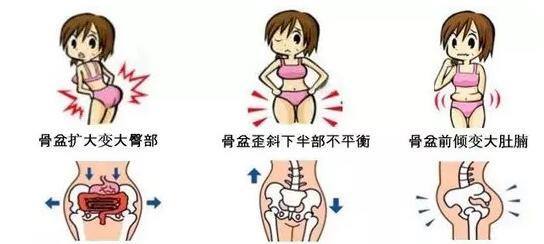 据统计,生完孩子,每3名妈妈中就有2人有腹直肌分离 .有没有