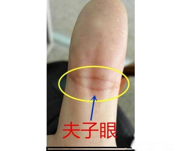 手相有夫子眼,大吉,但如果凤眼没有封闭,纹线断裂,必定会有病