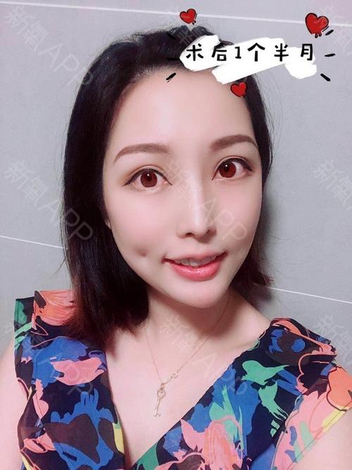 想做酒窝,有什么要注意的?