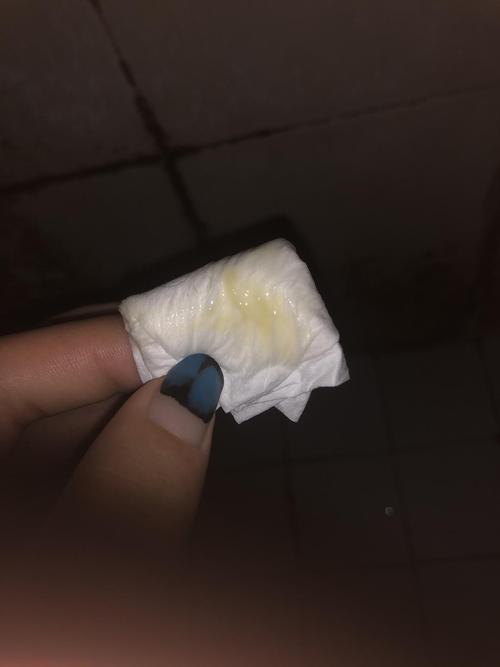 白带这样是正常还是有问题啊呜呜(有图慎)