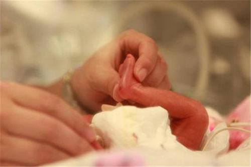 双胞胎"足月小样儿",父母未遵医嘱体检,结果致宝宝发育迟缓