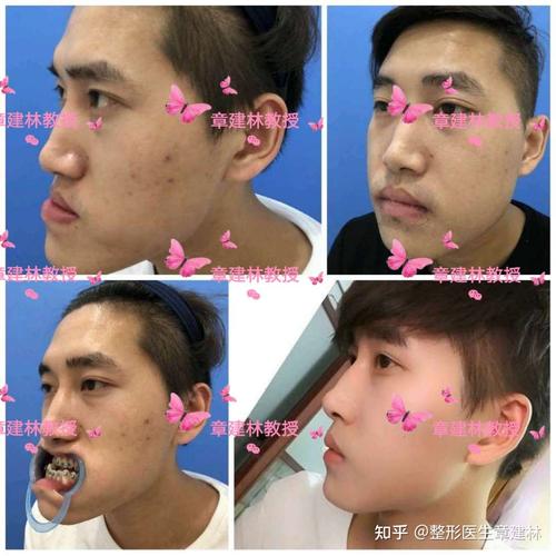 大家都说我是鞋拔子脸真的问题很大吗?