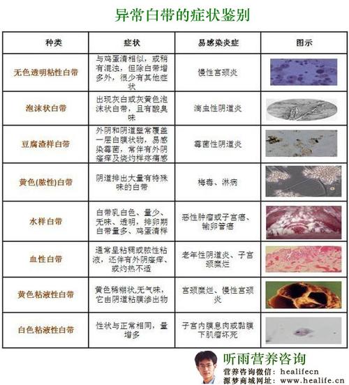 而且阴道炎还有很多很多种,例如细菌性阴道炎,假丝酵母菌阴道炎,老年