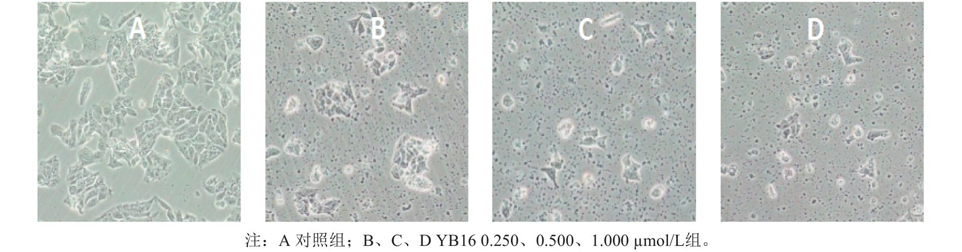 光镜下可见,对照组hct15细胞形态无变化