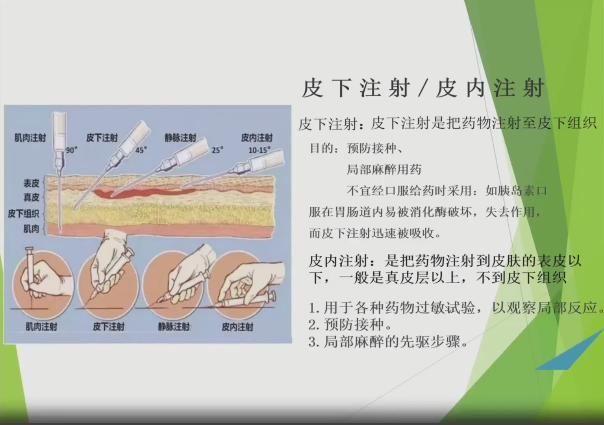 皮内注射—青霉素皮试