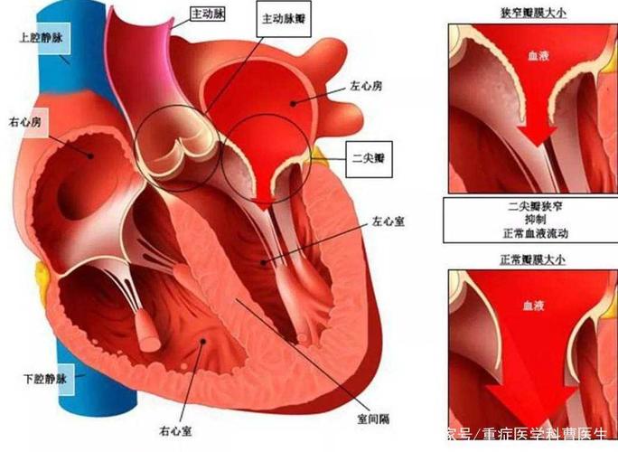 全腔镜下二尖瓣成型 三尖瓣成型 右心耳折叠术