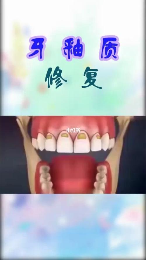 牙釉质损伤的主要原因是什么_刷牙_医疗健康_医疗健康