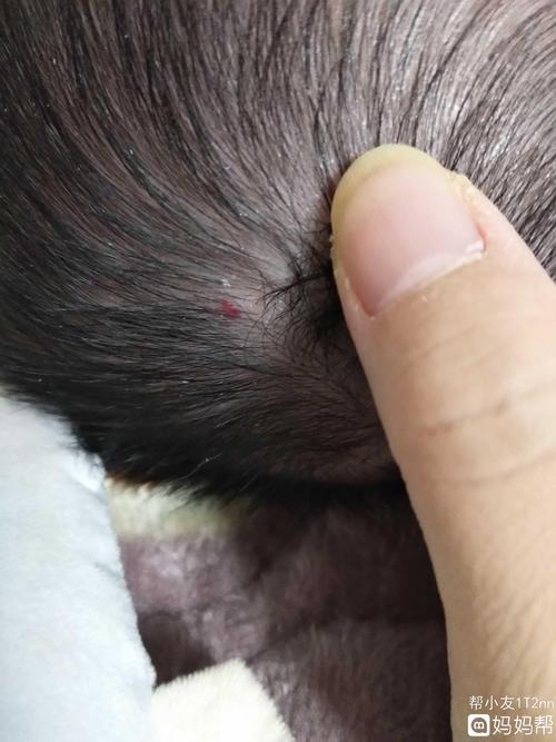 头上长了个红点