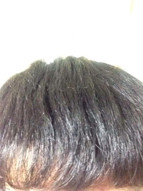 这样的头发可以做软化吗?之后会不会贴头皮很难看