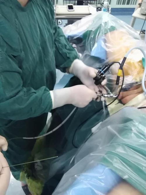 泌尿科完成我院首例"经尿道输尿管镜下输尿管探查 输尿管狭窄扩张术