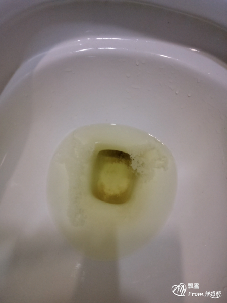 孕8周开始发现尿液中偶尔有痰液似的东西