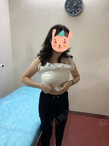 假体隆胸术后7天_隆胸术后7天_胸部术后7天_一只甜橘崽分享图片3
