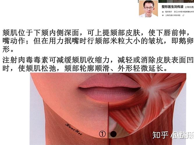 为取得更好的效果,在玻尿酸注射前一周行颏部肉毒素注射放松颏肌,不仅