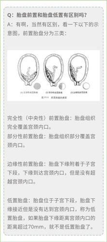 孖仔帮·双胎孕期答疑第2期|b超提示胎盘低置怎么办