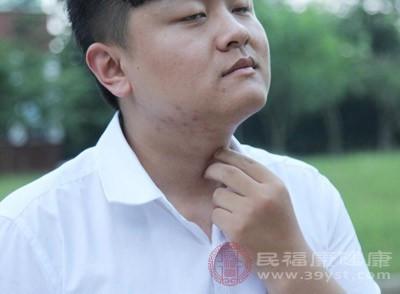 (3)压迫上腔静脉引起面部,颈部,上肢和上胸部静脉怒张,皮下组织水肿