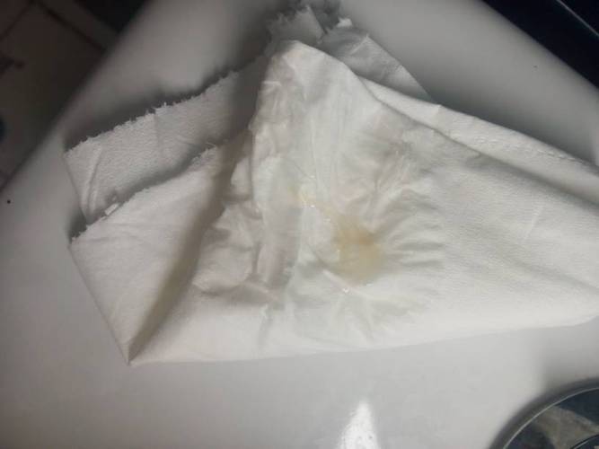 这样的白带正常吗?