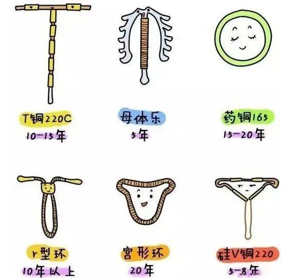 被数千万女性遗忘在体内的ta,该取出来了