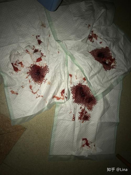 上海三甲医院割个扁桃体差点没命,你们信不信?