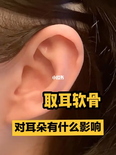 取耳软骨对耳朵有什么影响?_鼻综合_耳软骨鼻综合_美妆_医美整形