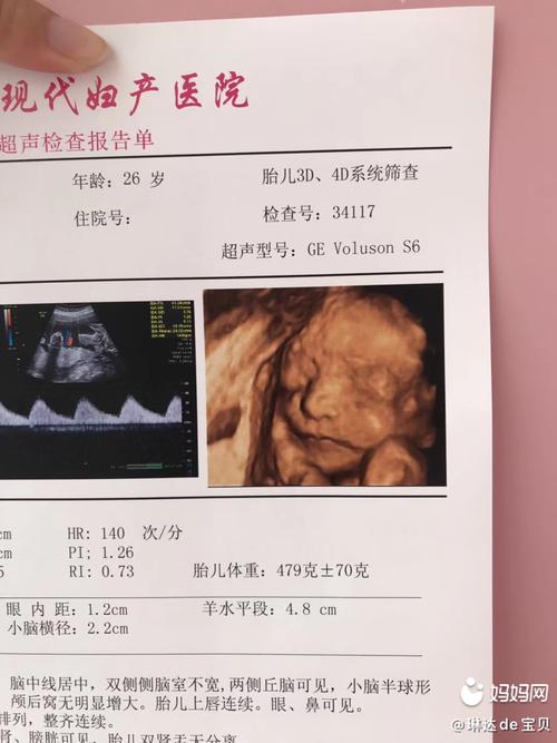 祩5 5是我闺女24周的四维彩超,一次过