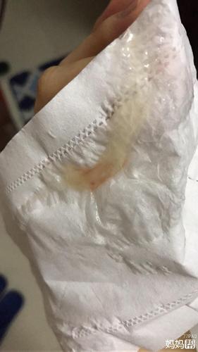 预产期超三天了,最近都有水样分泌物