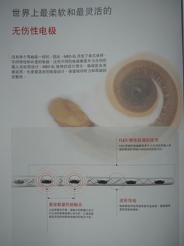 奥地利人工耳蜗最新concerto植入体性能介绍