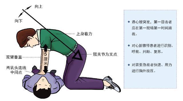 国际协会倡议简化心肺复苏流程,挽救生命只需做到"检查-呼救-按压"