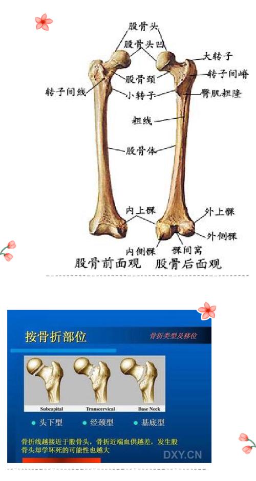 股骨颈骨折髋关节置换术后功能锻炼