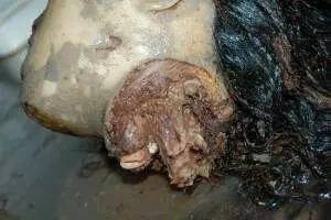 社会 正文  尸块足有 6斤重!