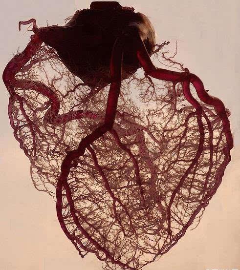 利用螺旋ct扫描,再经过计算机处理重建得出的心脏冠状动脉成像的一种