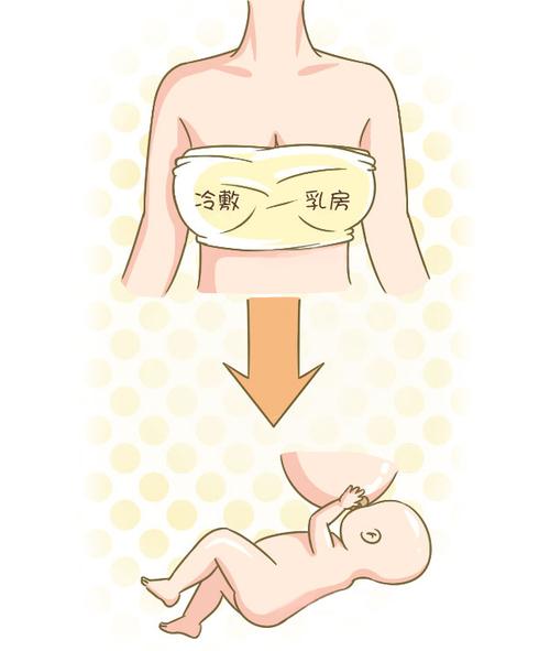 乳腺炎是由细菌引起的,而且还是哺乳期间乳汁分泌较多,没有及时挤出会