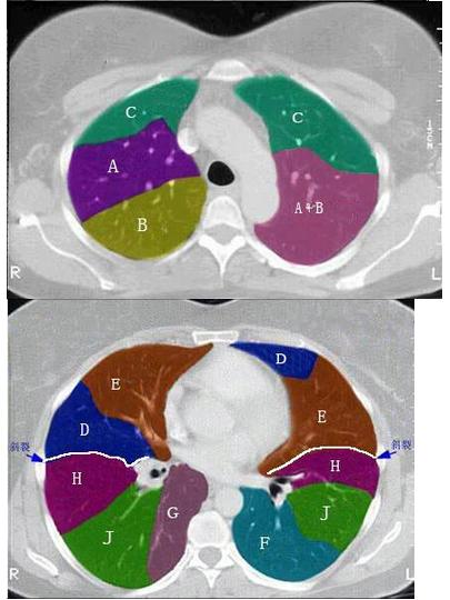 结合肺段模式图,选出右肺下叶的组成()