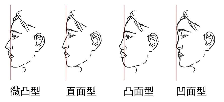 好羡慕那种侧着脸,一看就很女神的样子_新氧美容整形