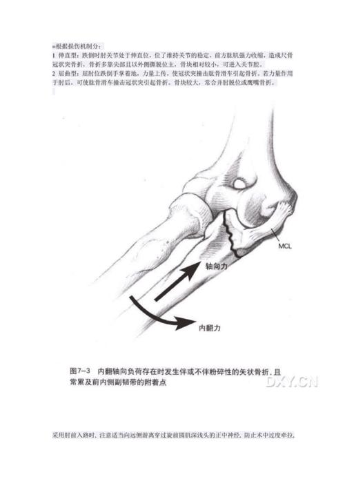 尺骨冠突骨折的分型及治疗