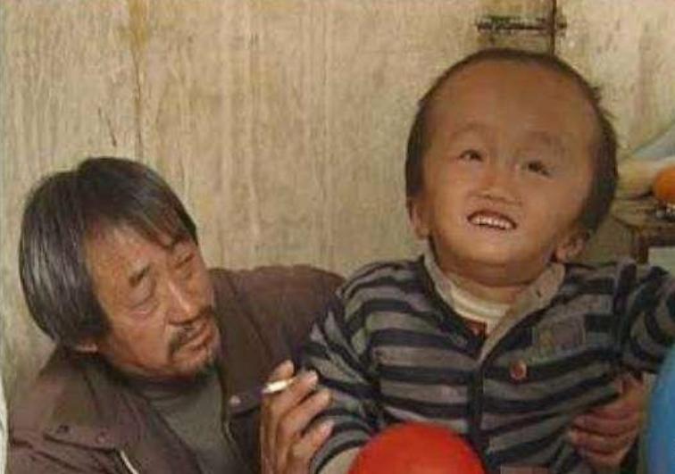 12年了当年因喝三鹿奶粉变成的大头娃娃现如今怎么样了