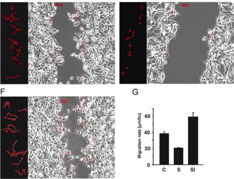 [转载]matrigel invasion assays (基质胶侵袭实验)