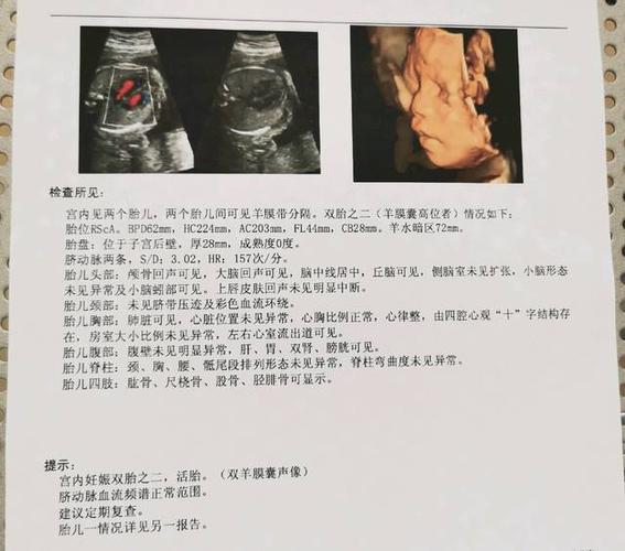 四维单子3秒钟看男是女.