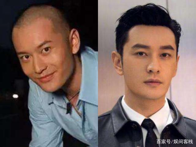 哪些明星的发际线超出了你的想象?