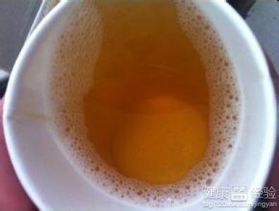 尿液颜色的介绍